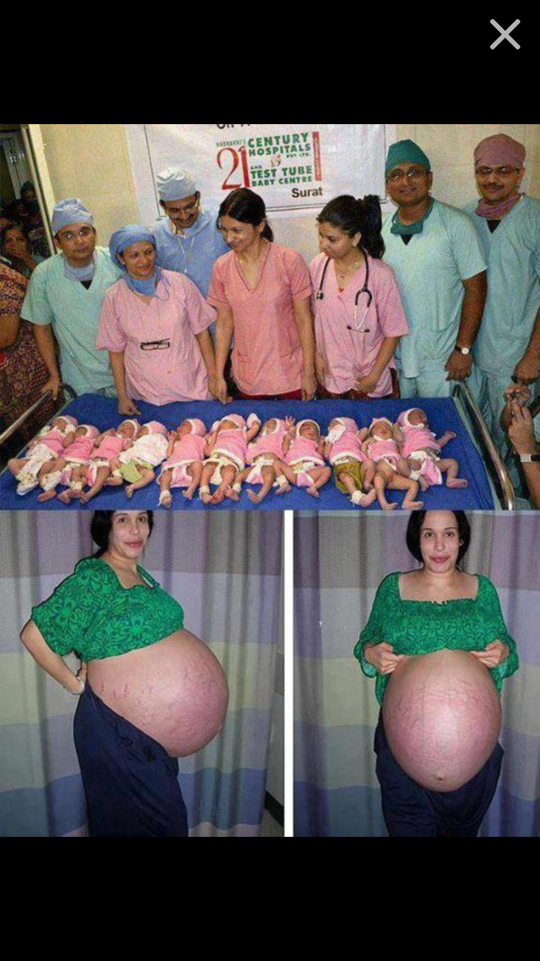 포스트의 이미지