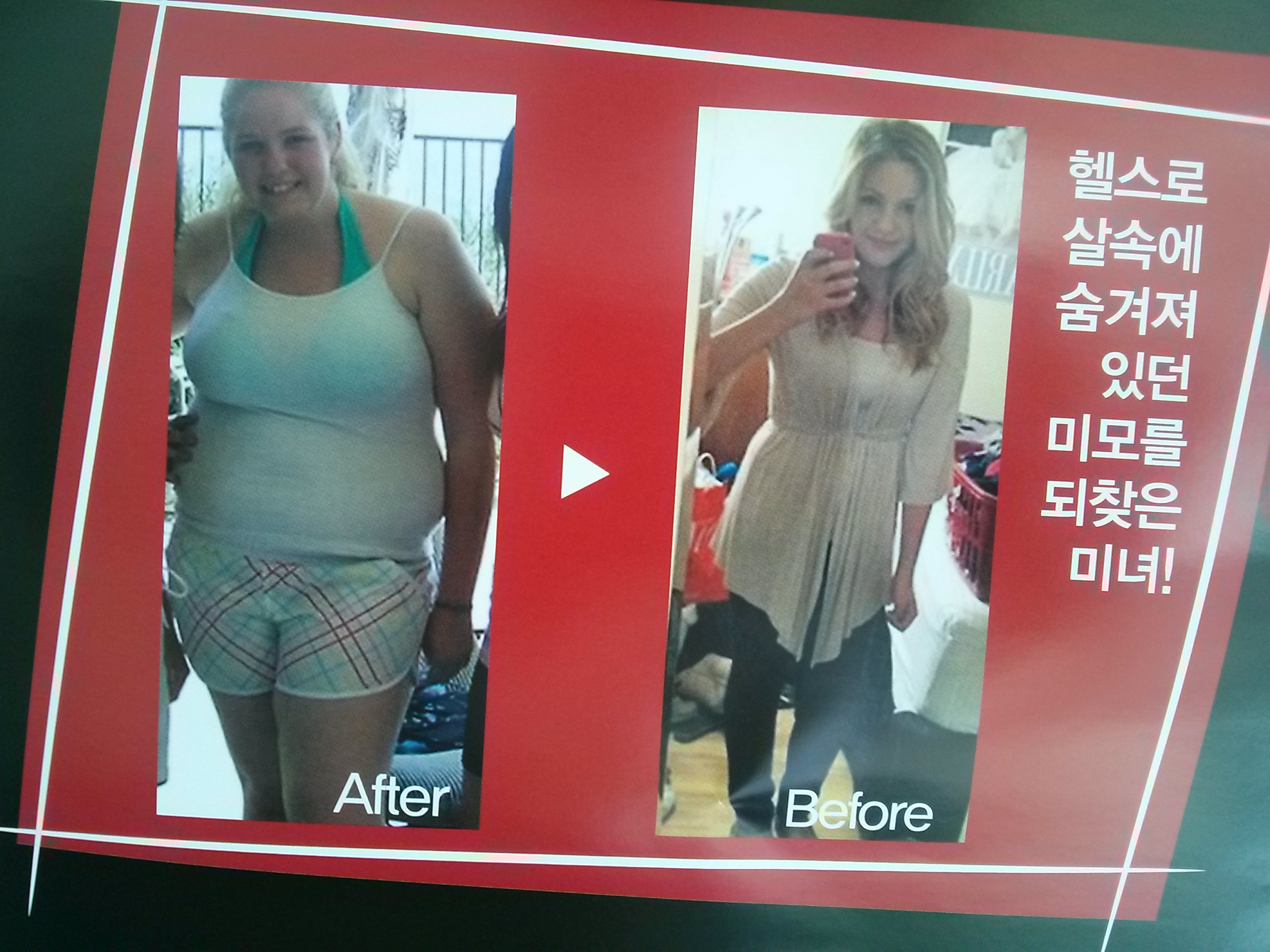 포스트의 이미지