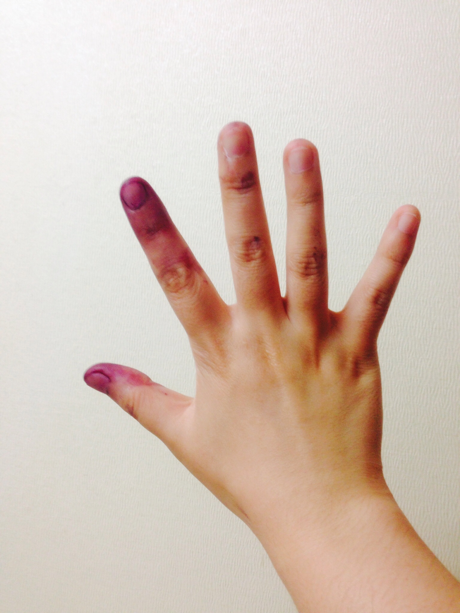 포스트의 이미지