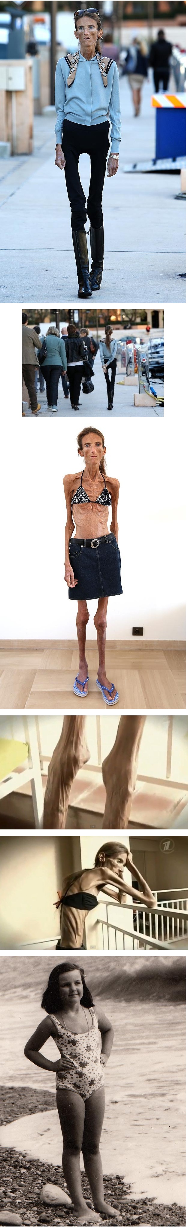 포스트의 이미지