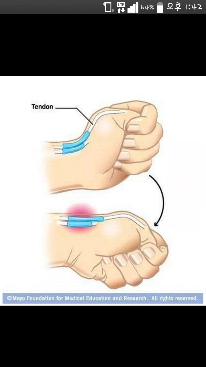 초간단 2초만에 스마트폰중독 확인 테스트