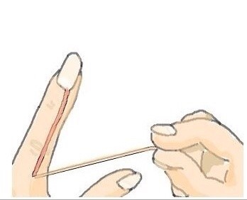 포스트의 이미지