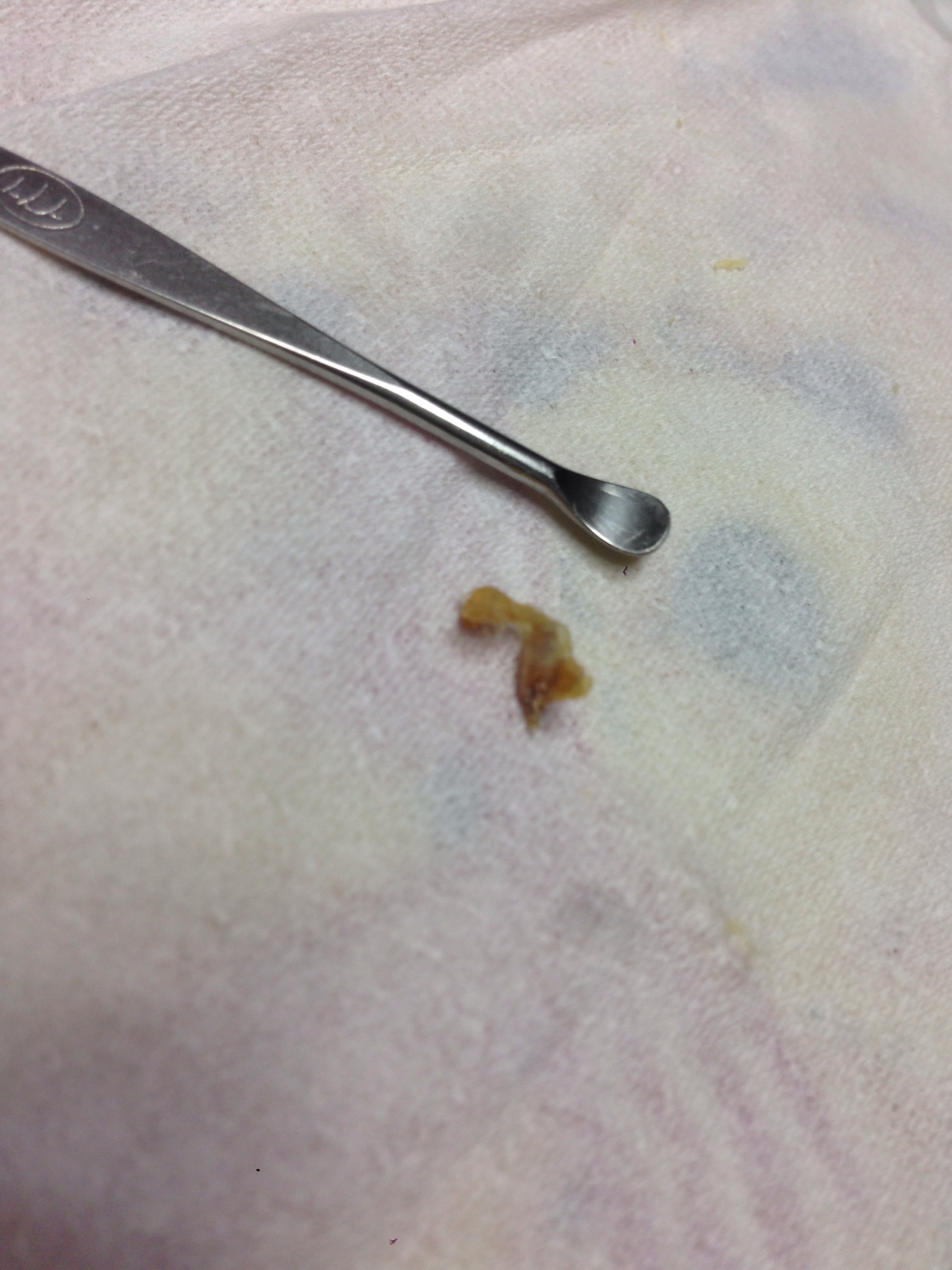 포스트의 이미지