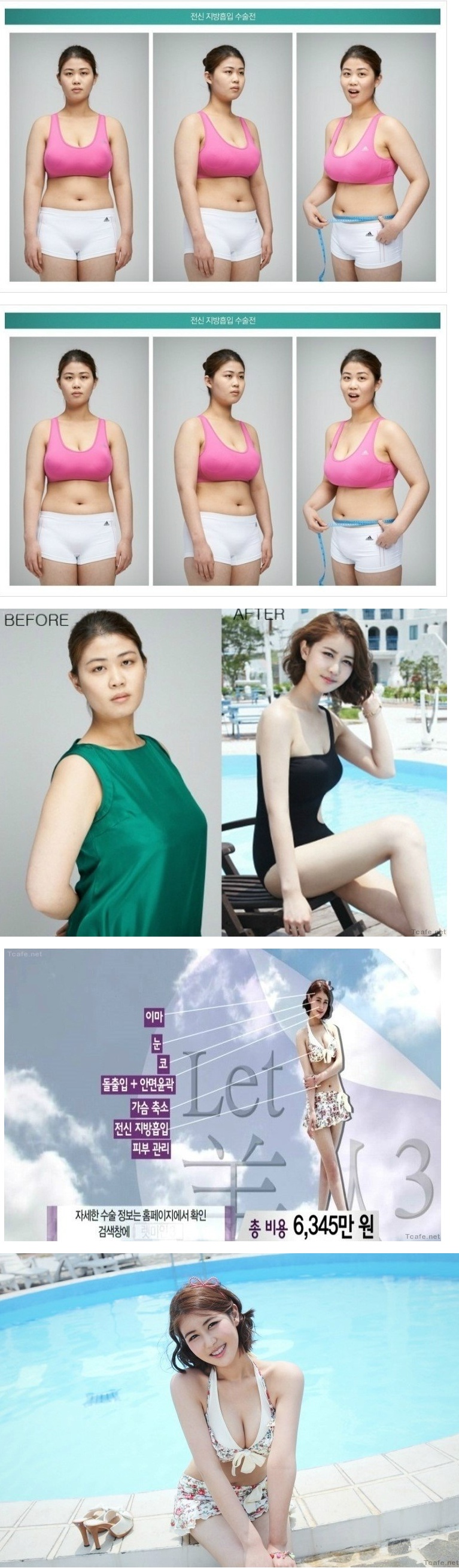 포스트의 이미지