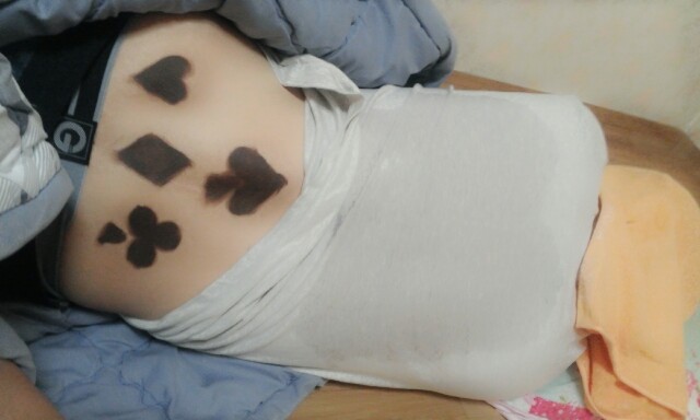 포스트의 이미지