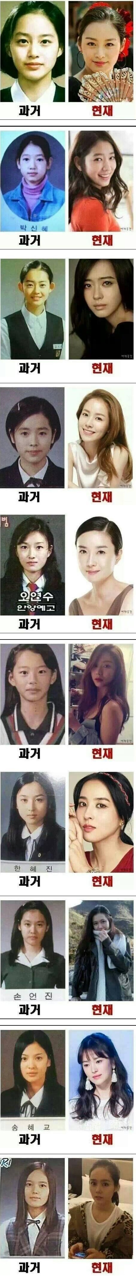 포스트의 이미지