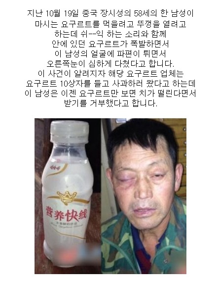 포스트의 이미지