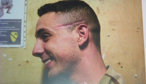 포스트의 이미지