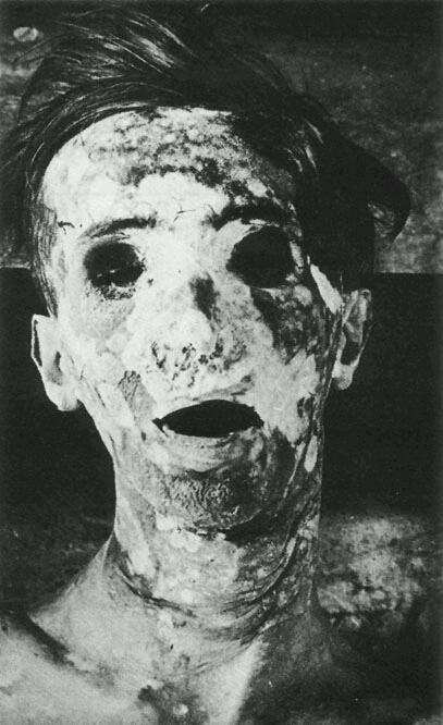 포스트의 이미지