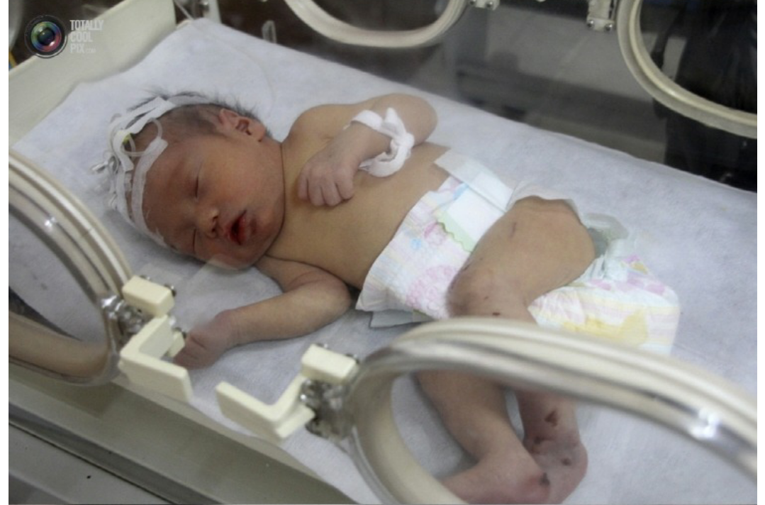 포스트의 이미지