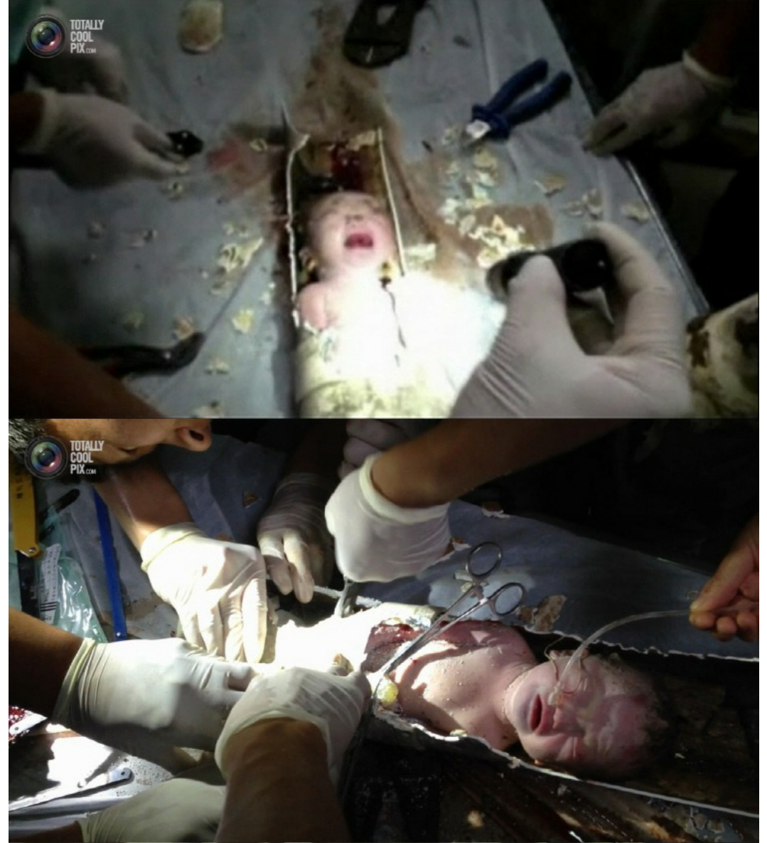 포스트의 이미지