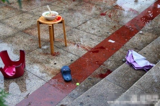 포스트의 이미지