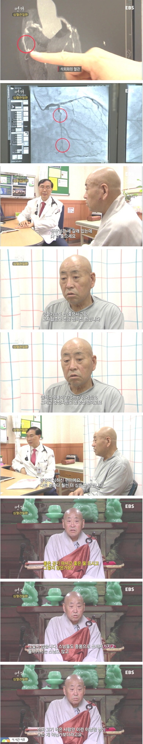 포스트의 이미지