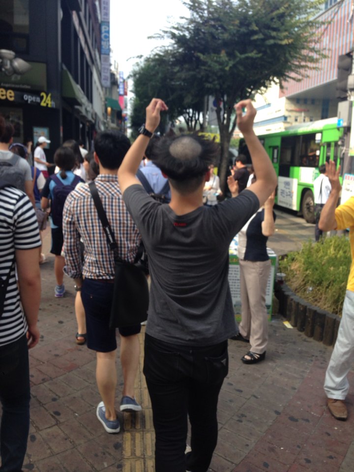 나만의원형탈모