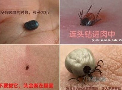 포스트의 이미지