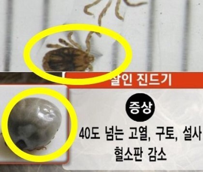 포스트의 이미지