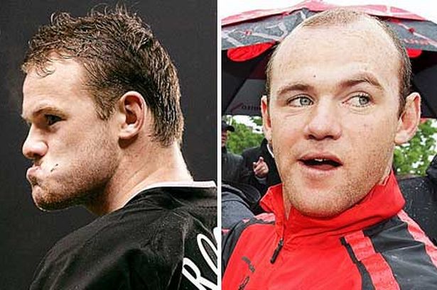 포스트의 이미지