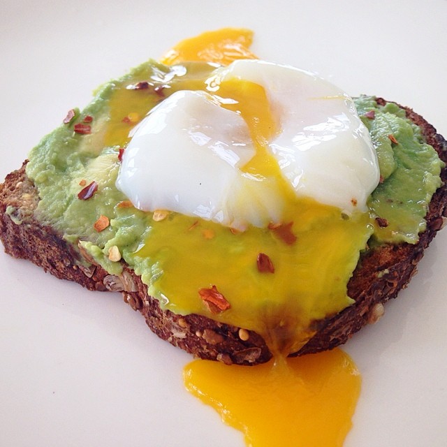 포스트의 이미지