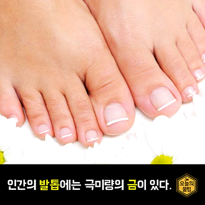 포스트의 이미지