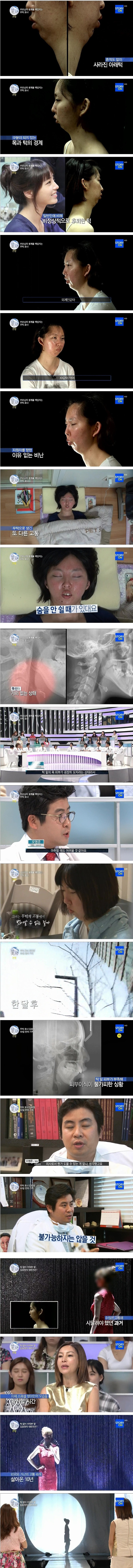 포스트의 이미지