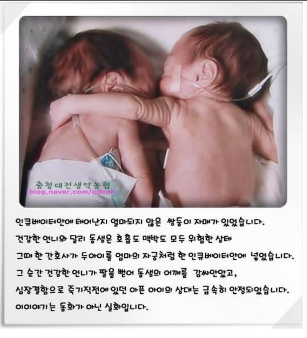 포스트의 이미지
