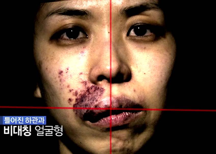 포스트의 이미지