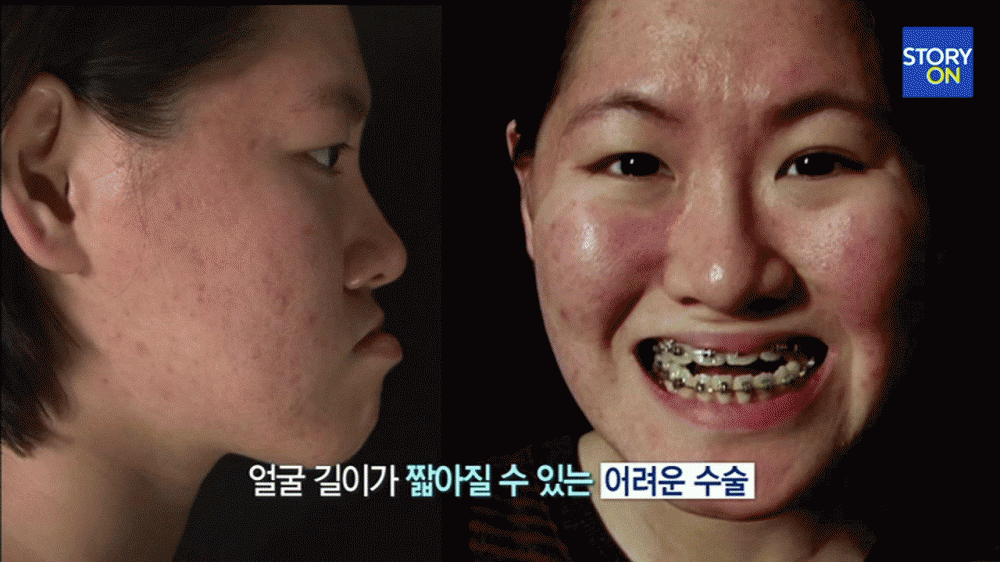 포스트의 이미지