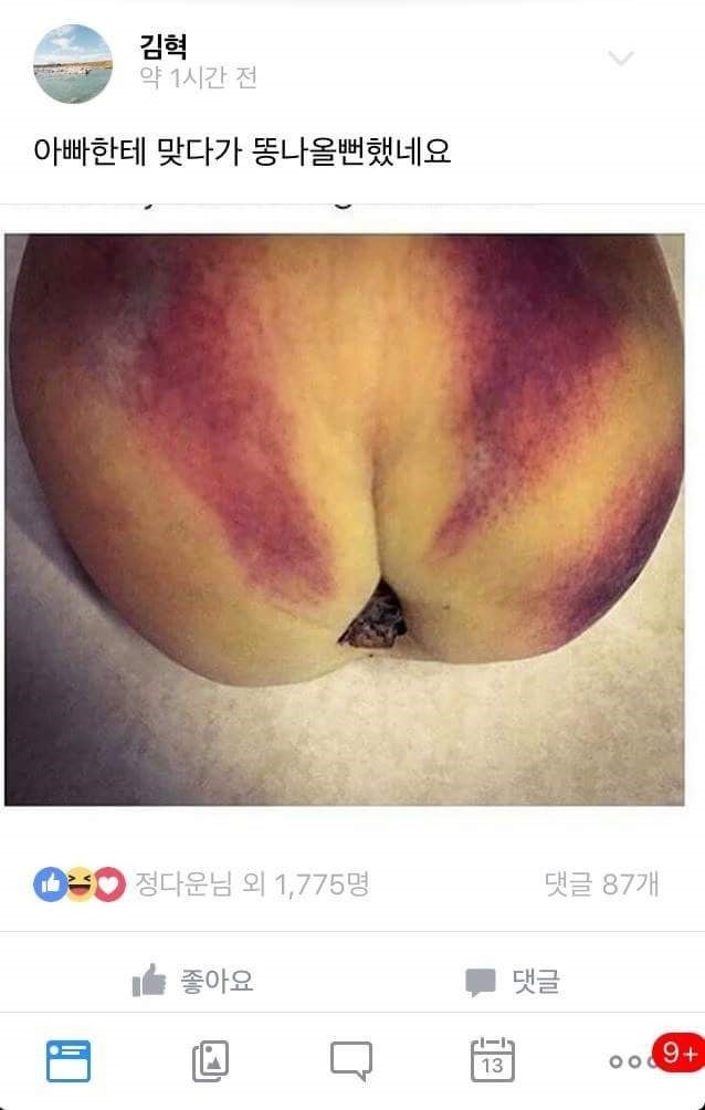 허언증 갤러리 근황